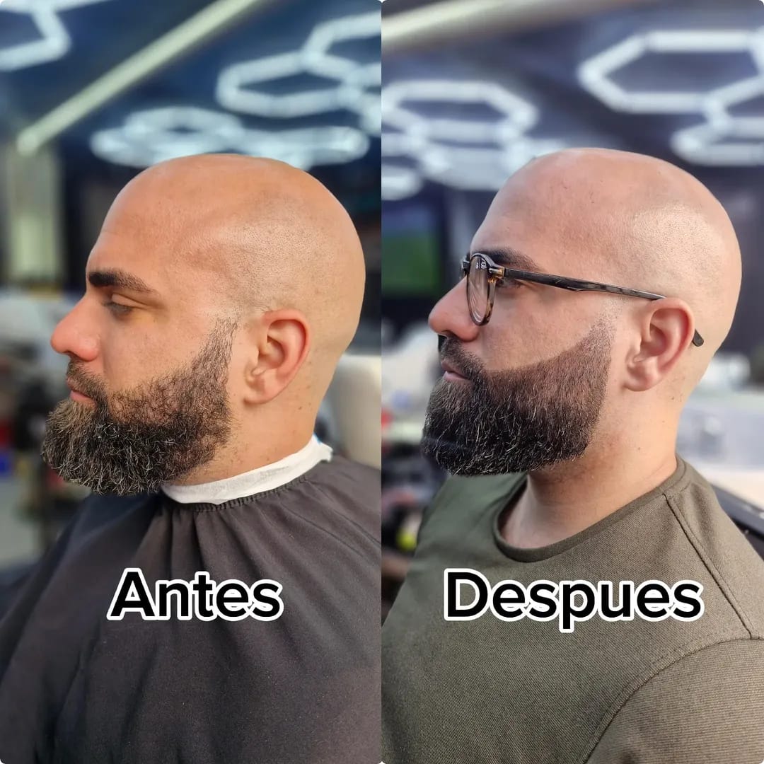Antes y después, visagismo y corte, cliente 3